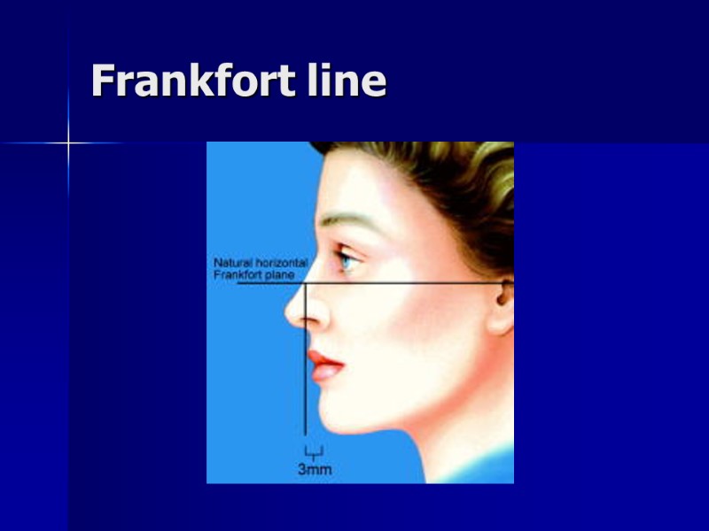 Frankfort line